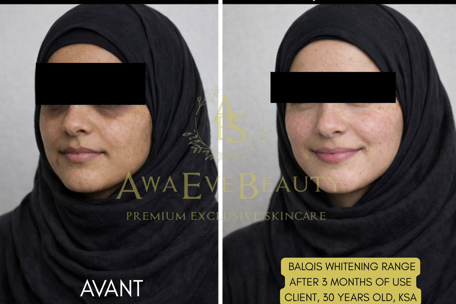 Gamme Blanchissante Balqis (avec Gel)