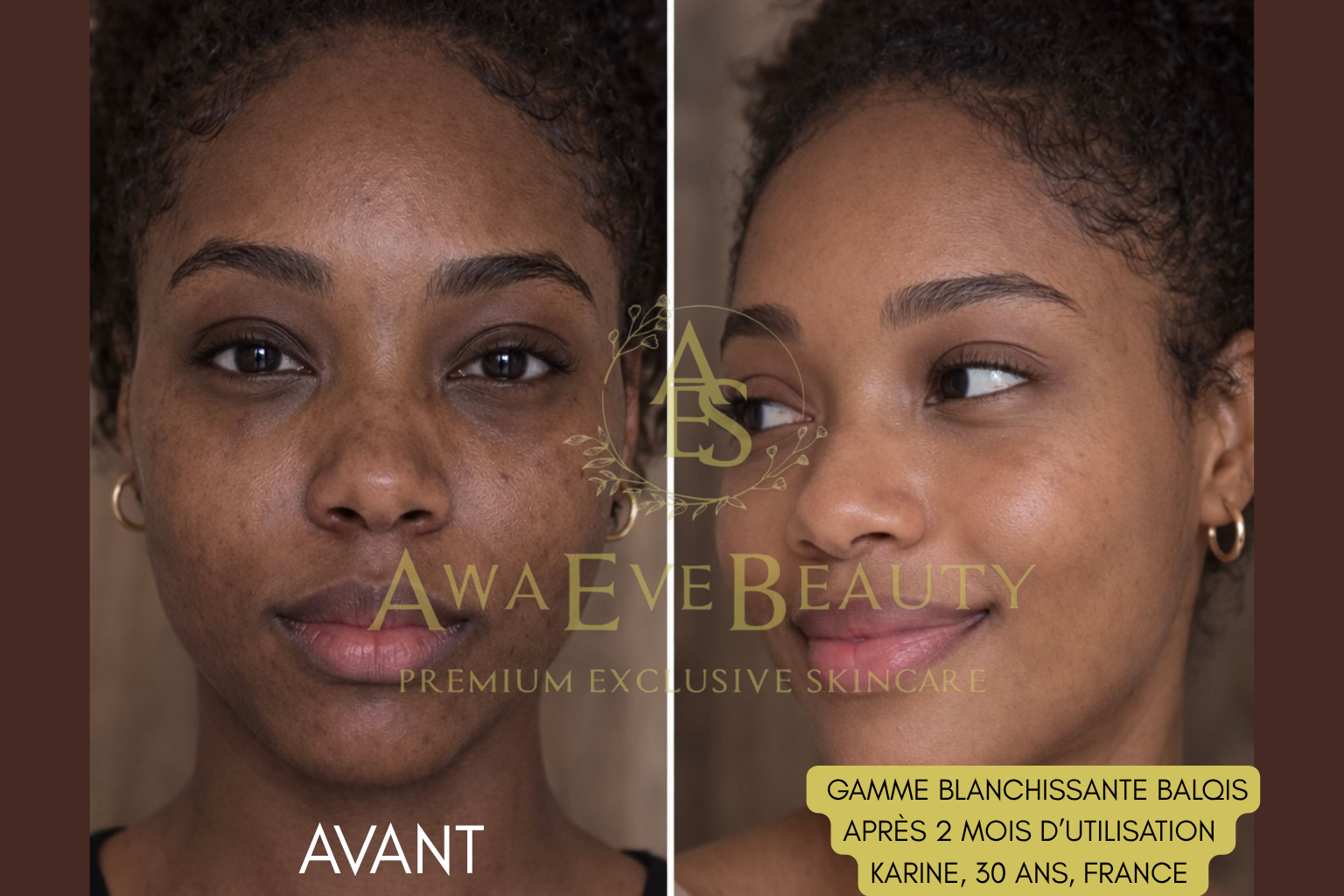 Gamme Blanchissante Balqis (avec Gel)