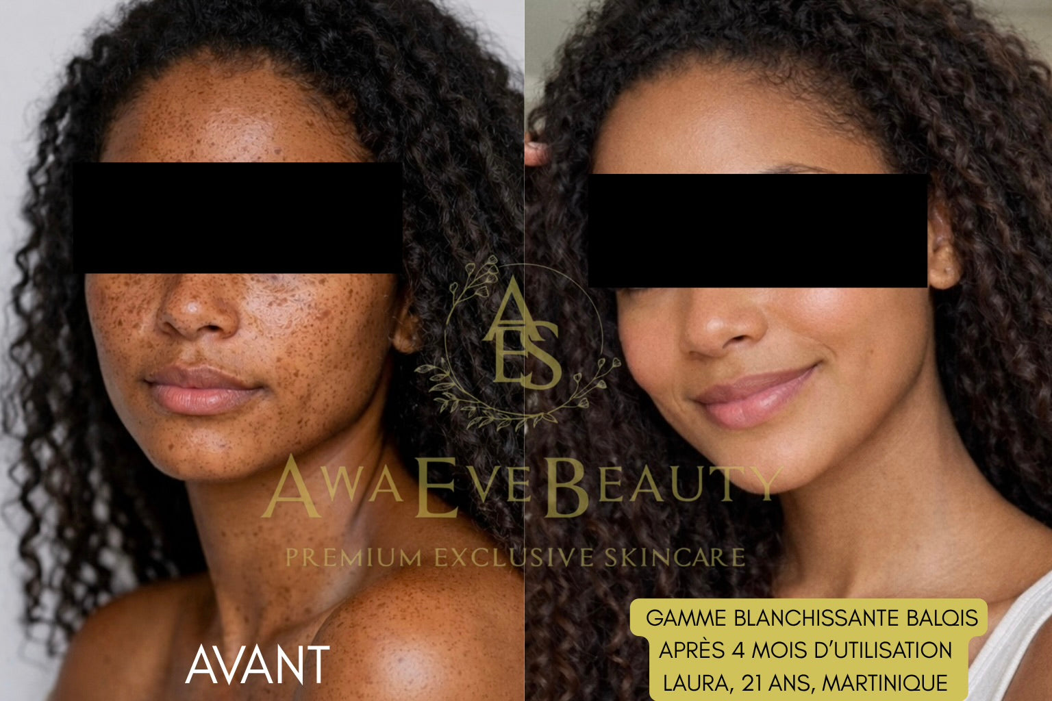 Gamme Blanchissante Balqis (avec Gel)