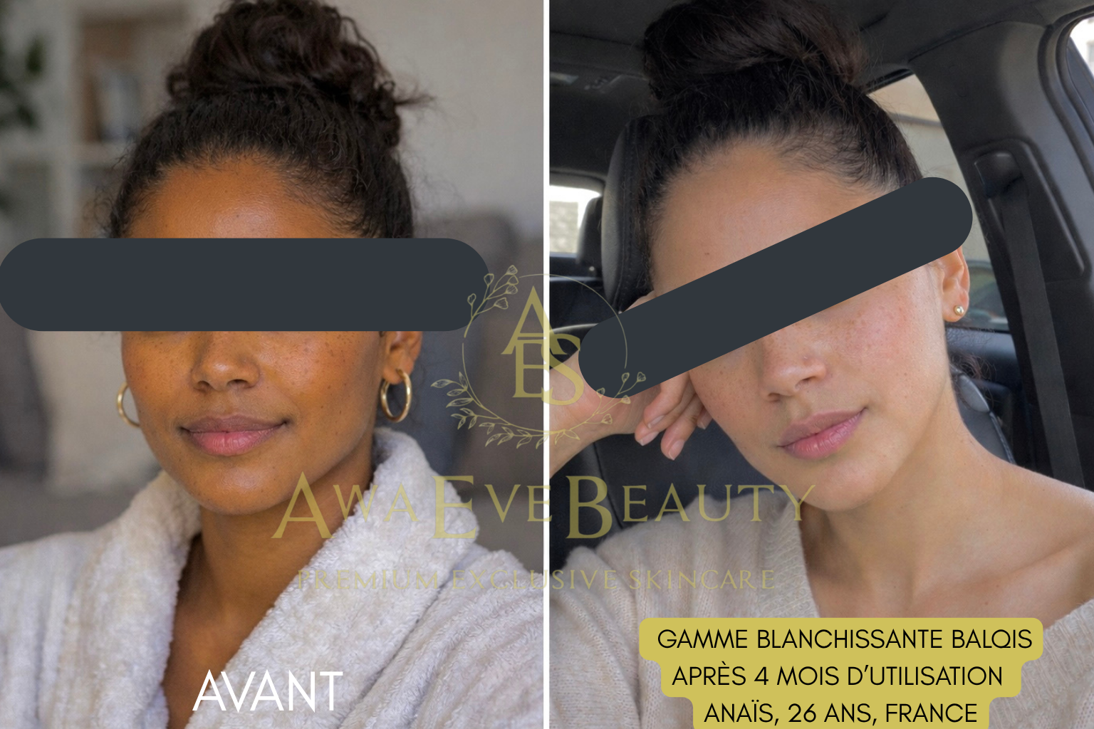 Gamme Blanchissante Balqis (avec Gel)